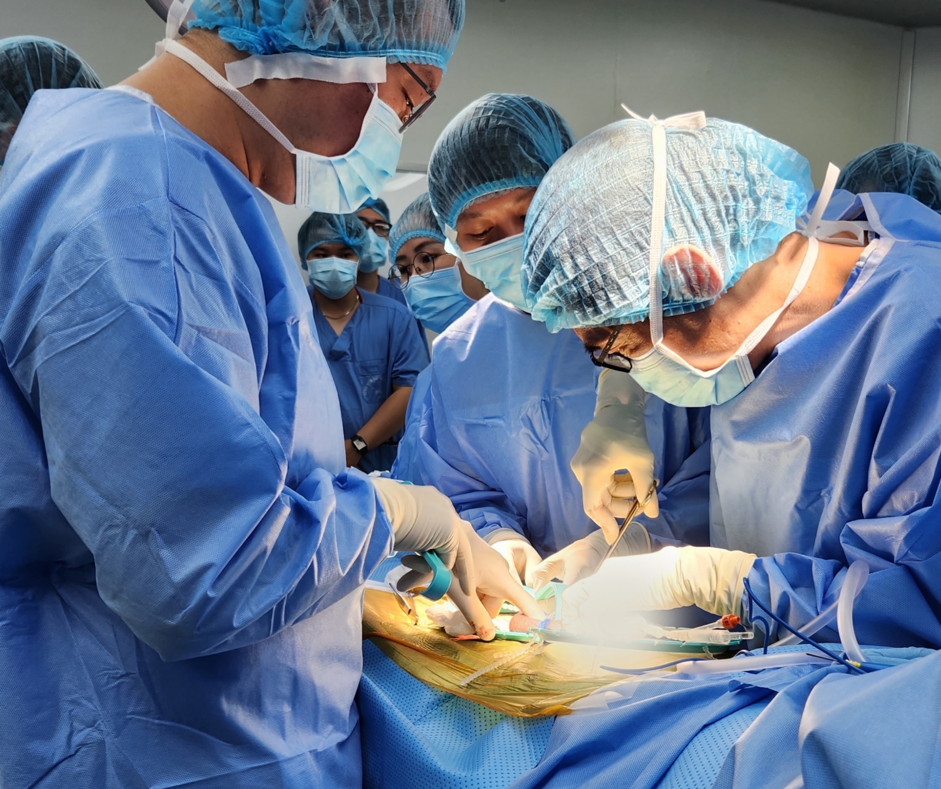 Cấp cứu trường hợp thoát vị bẹn nghẹt