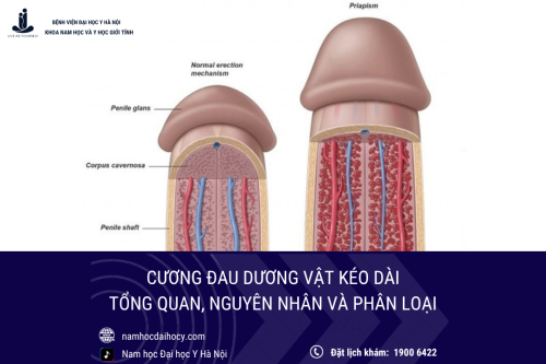 Cương đau dương vật kéo dài: Tổng quan, nguyên nhân và phân loại