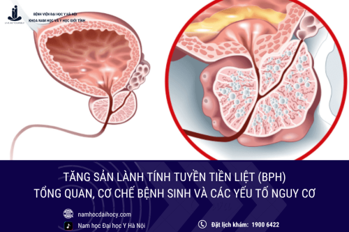 Tăng sản lành tính tuyến tiền liệt: Tổng quan, cơ chế bệnh sinh và các yếu tố nguy cơ