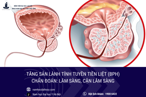 Tăng sản lành tính tuyến tiền liệt: Chẩn đoán lâm sàng, cận lâm sàng