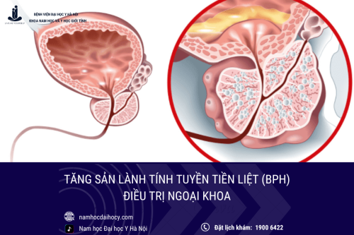 Tăng sản lành tính tuyến tiền liệt: Điều trị ngoại khoa (phần 2)