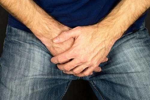 Giãn tĩnh mạch tinh là gì? Nhận diện 