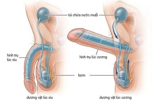 Cương đau dương vật kéo dài: Chẩn đoán