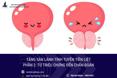 Nhận biết sớm tăng sản tuyến tiền liệt lành tính: Từ triệu chứng đến chẩn đoán chính xác