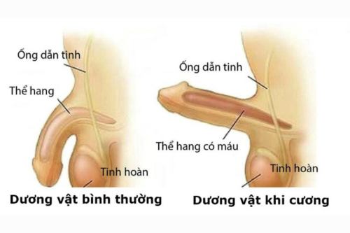 Cương đau dương vật kéo dài: Điều trị
