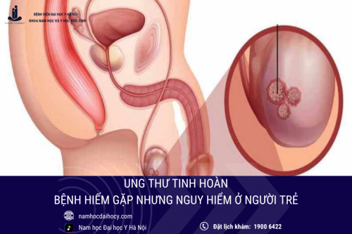Ung thư tinh hoàn: Căn bệnh hiếm gặp nhưng nguy hiểm ở người trẻ