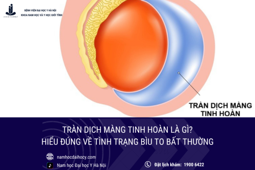 Tràn dịch màng tinh hoàn: Hiểu đúng về tình trạng bìu to bất thường