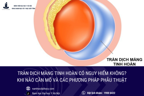Tràn dịch màng tinh hoàn: Khi nào nguy hiểm và các phương pháp điều trị