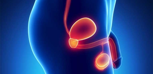 Giãn tĩnh mạch tinh gây vô sinh như thế nào và các biện pháp chẩn đoán